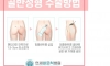 요즘 골반 성형하는 방법