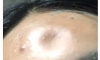 여자친구 딱밤 대참사