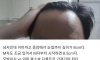 이마 8cm다 자괴감 든다