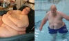 몸무게의 절반 이상을 뺀 세계에서 가장 뚱뚱했던 사나이