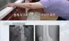 면 중독 아주머니의 건강상태