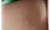 하트