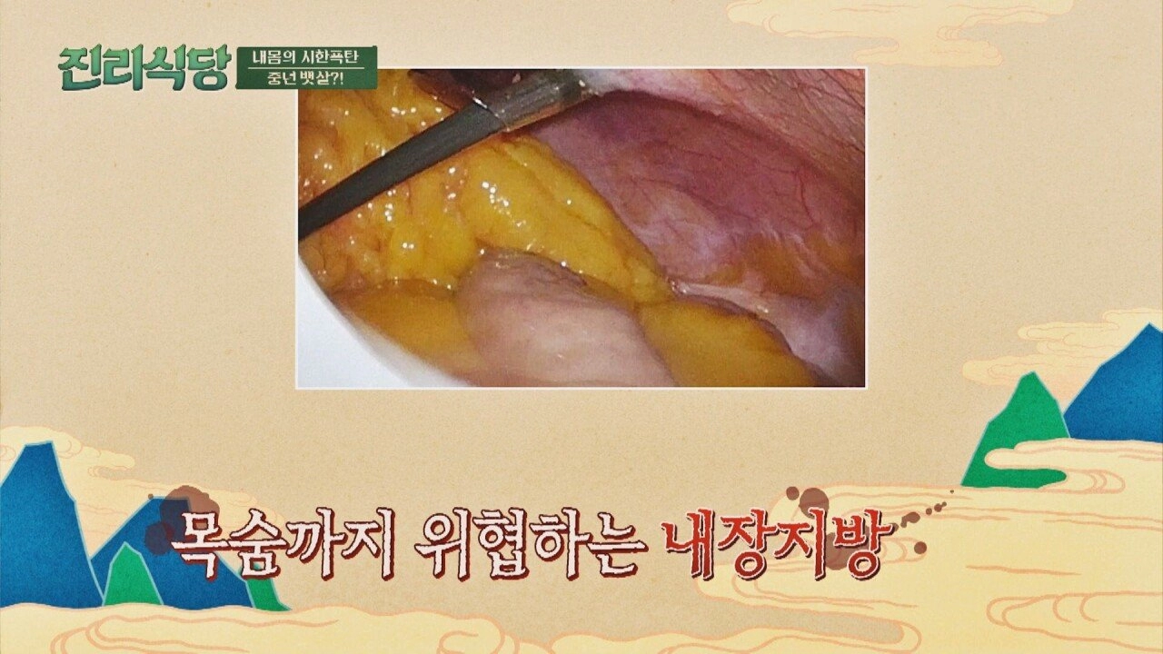 몸 속에 내장지방 차곡차곡 쌓였을때 모습..gif