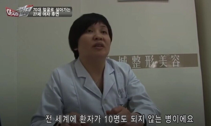 실제 나이는 20대인데 70대 얼굴로 살아가는 여자