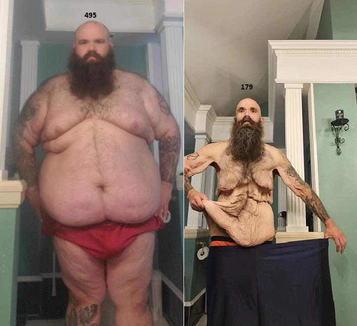 145kg 감량한 남자