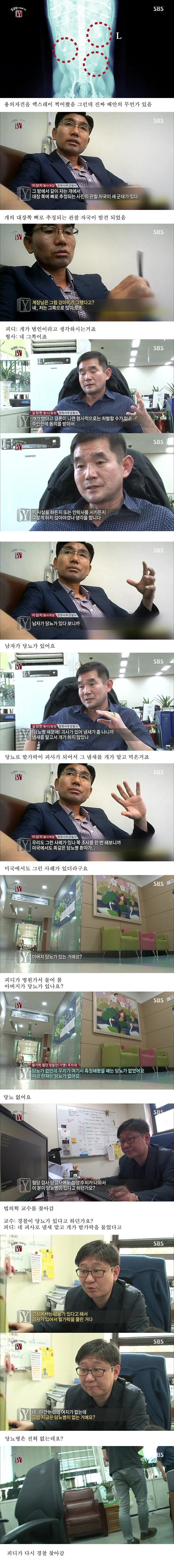 자고 일어나니 발가락이 모조리 사라진 사건