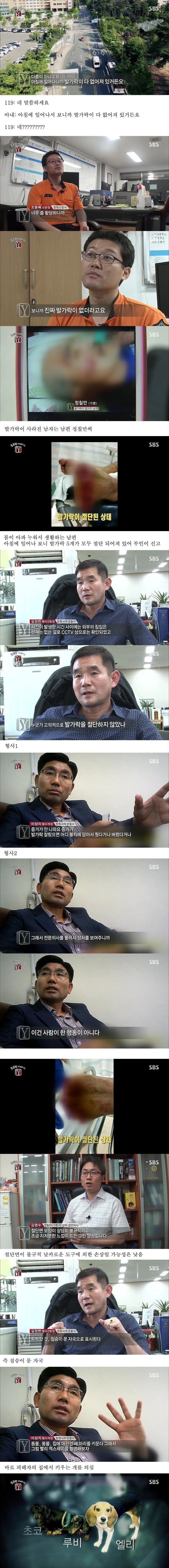 자고 일어나니 발가락이 모조리 사라진 사건