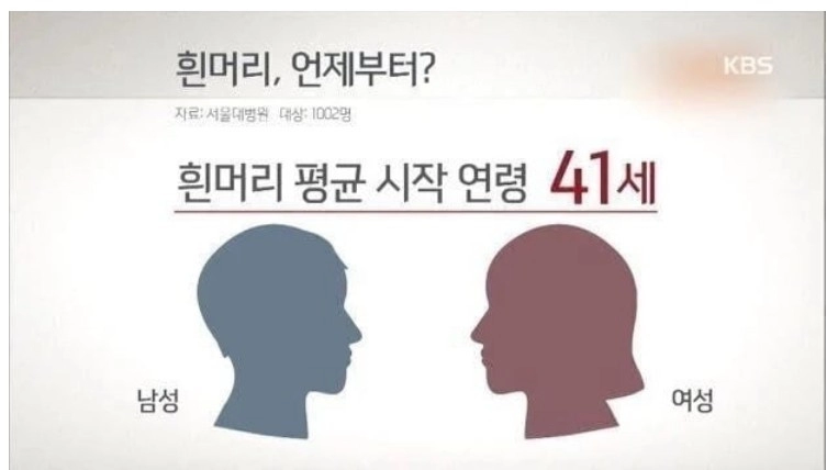 흰머리 평균 시작 연령