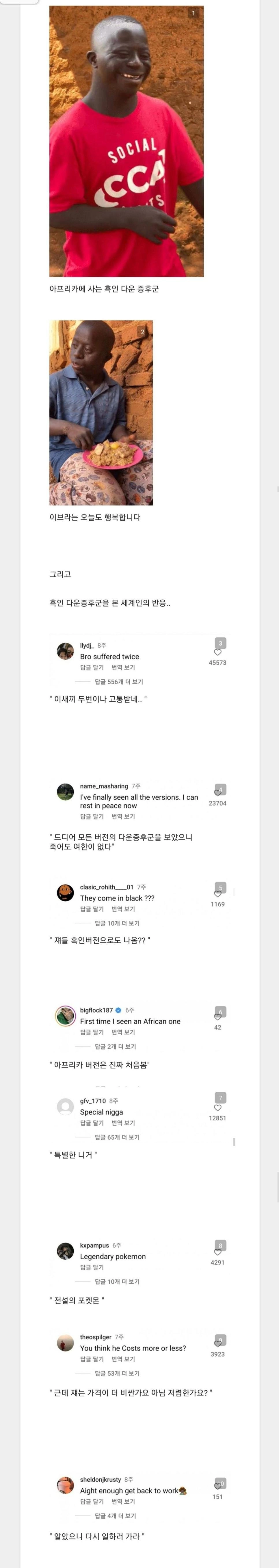 흑인 다운증후군을 본 세계인의 반응