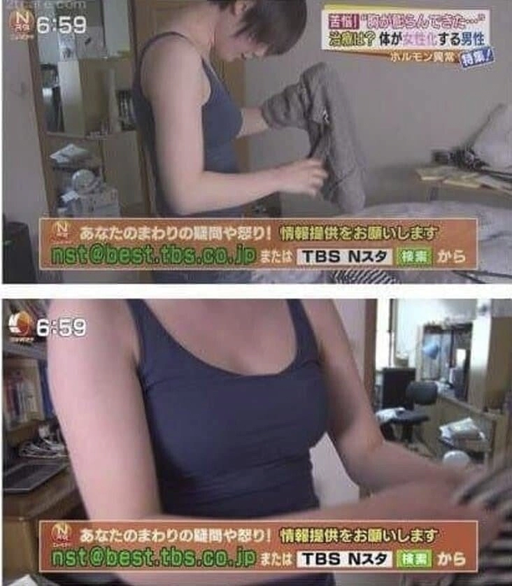 병 때문에 여자의 몸이 된 남성