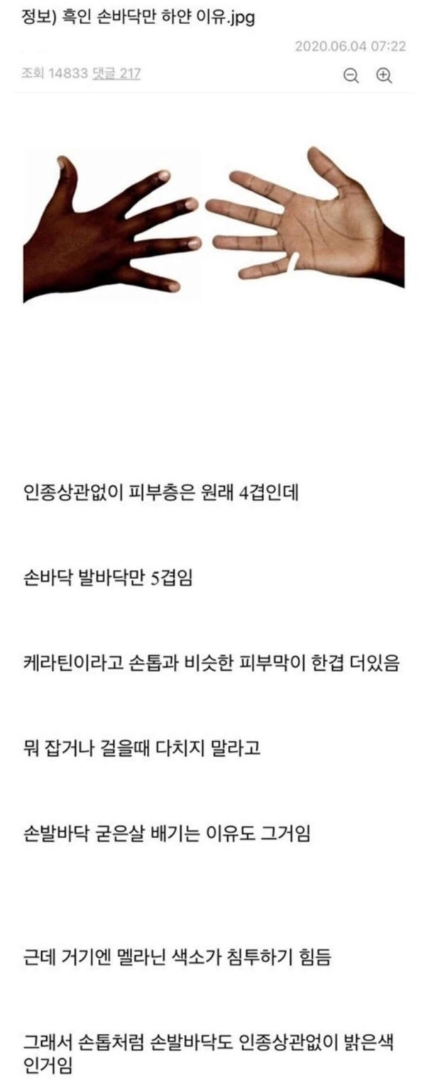 흑인 손바닥이 하얀 이유