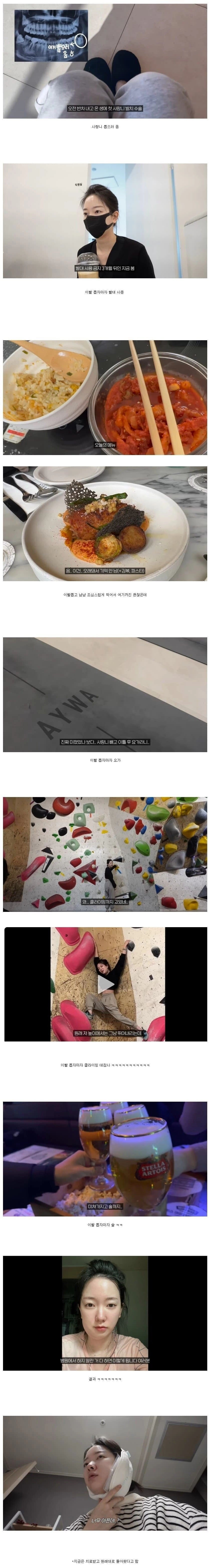 사랑니 뽑은 후 의사말 안듣고 마음대로 해버린 사람의 최후