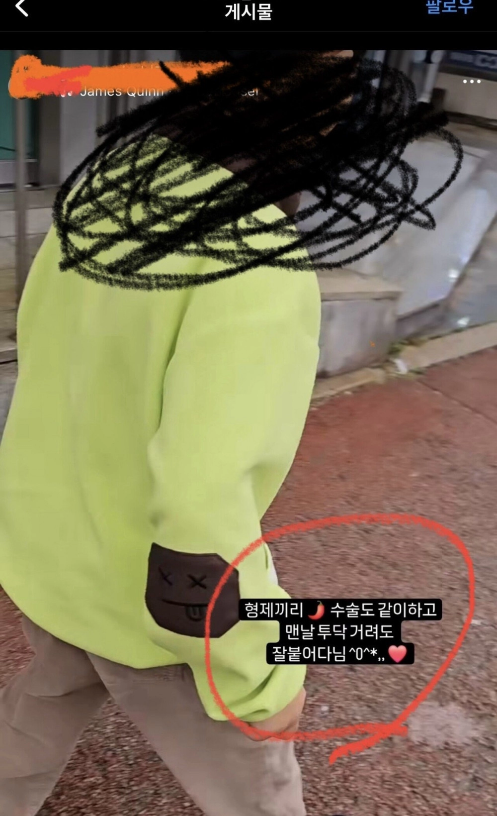아들 둘 포경수술 릴스 올린 엄마 + 댓글반응 ㄷㄷ