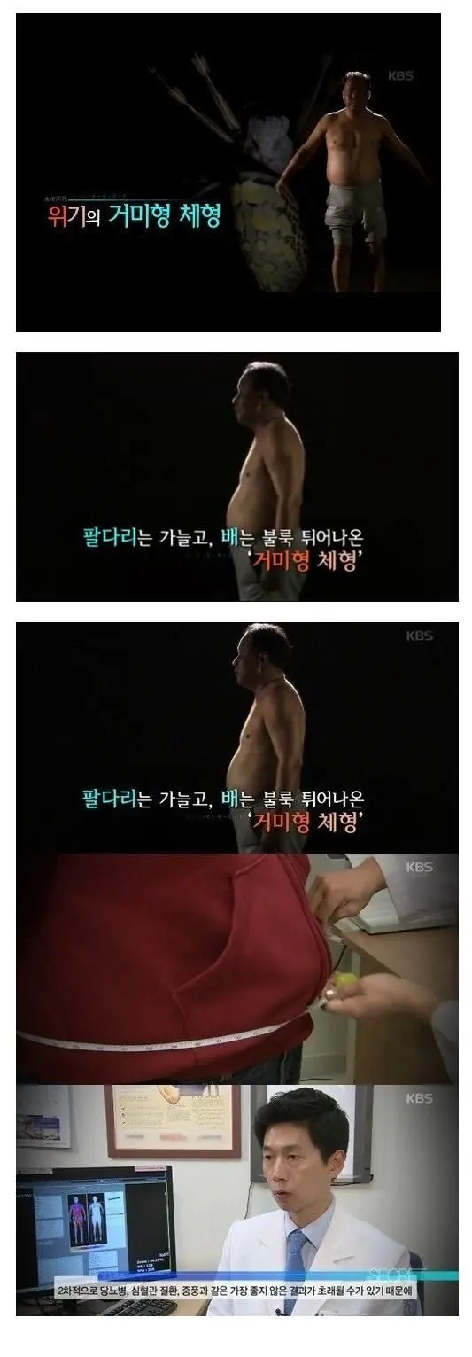 의사들이 지목한 가장 위험한 체형