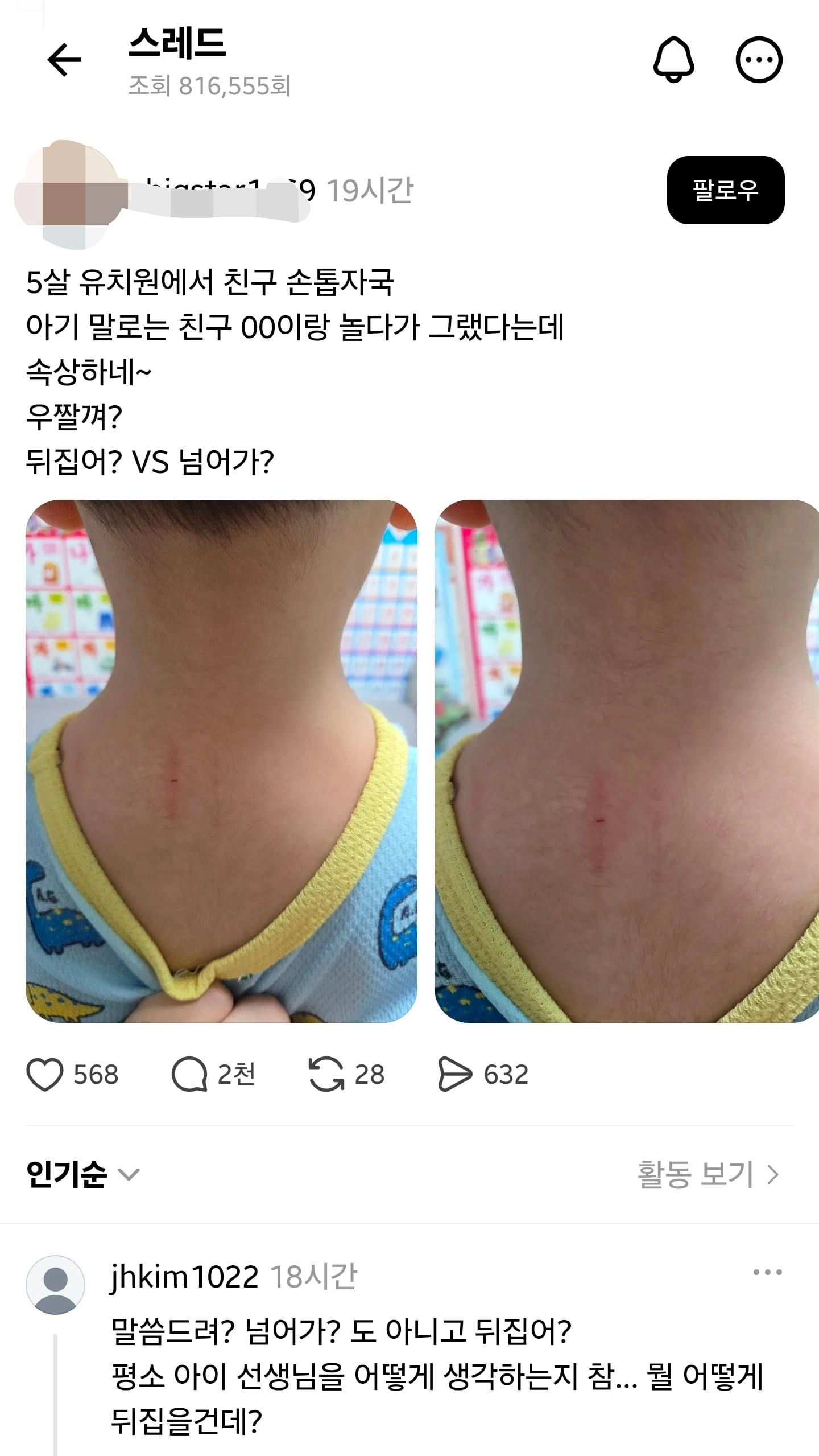 이걸 뒤집어? 넘어가?