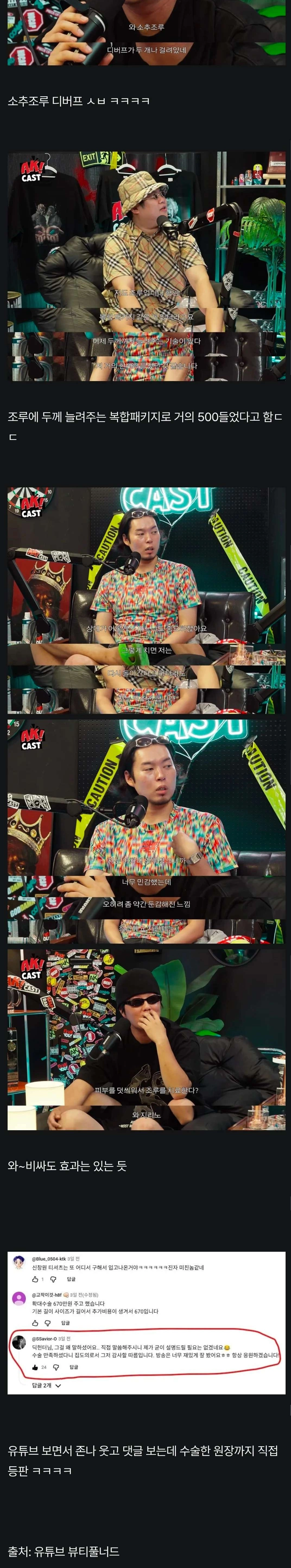 유튜버 최초! 음경확대수술 후기 공개