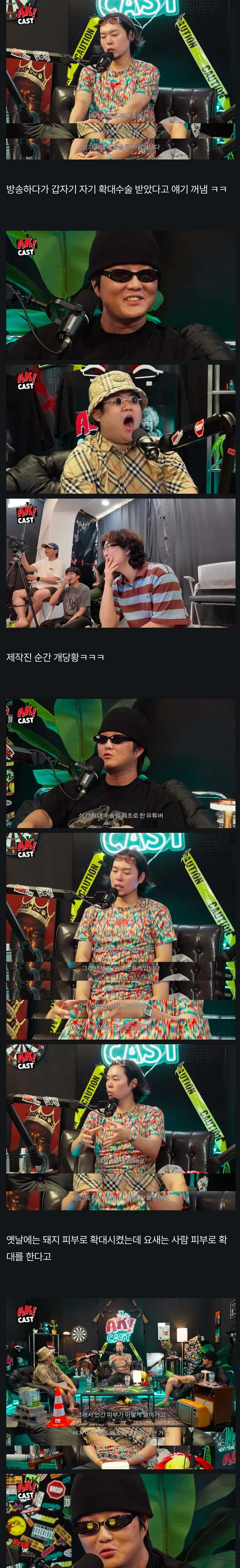 유튜버 최초! 음경확대수술 후기 공개