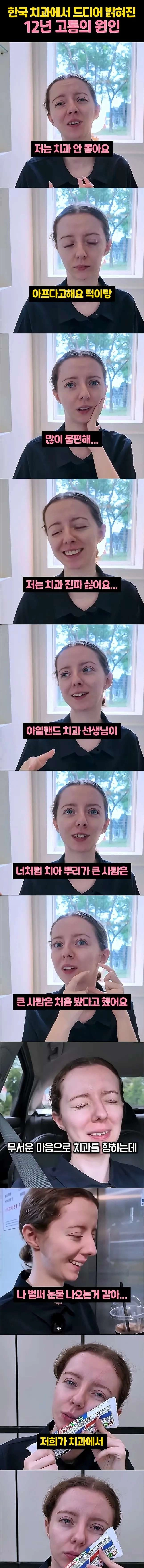 한국치과에서 밝혀진 아일랜드 아내 12년 치통의 원인