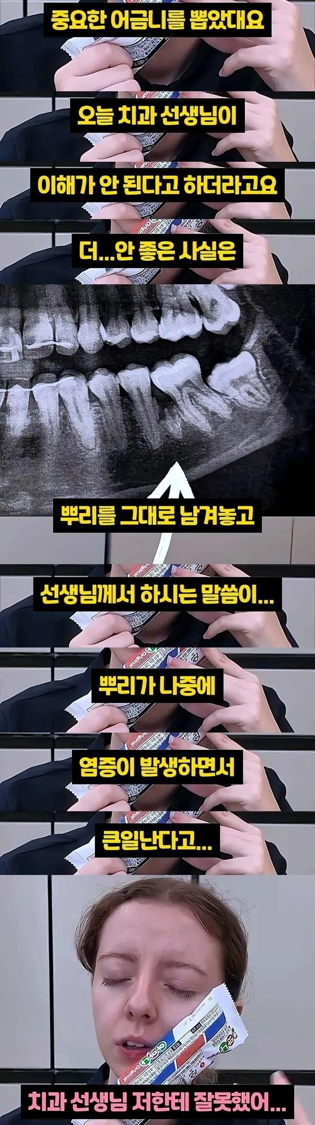 한국치과에서 밝혀진 아일랜드 아내 12년 치통의 원인