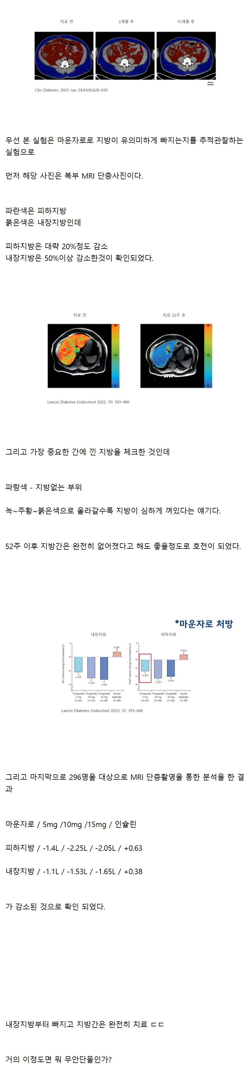 마운자로 맞으면 살이 어떻게 빠지는지 추적 조사한 결과
