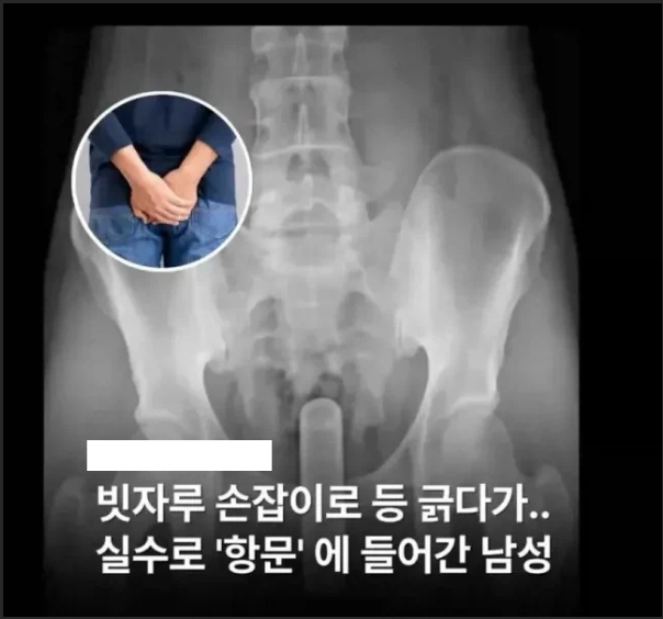 어... 이게 가능한 건가?