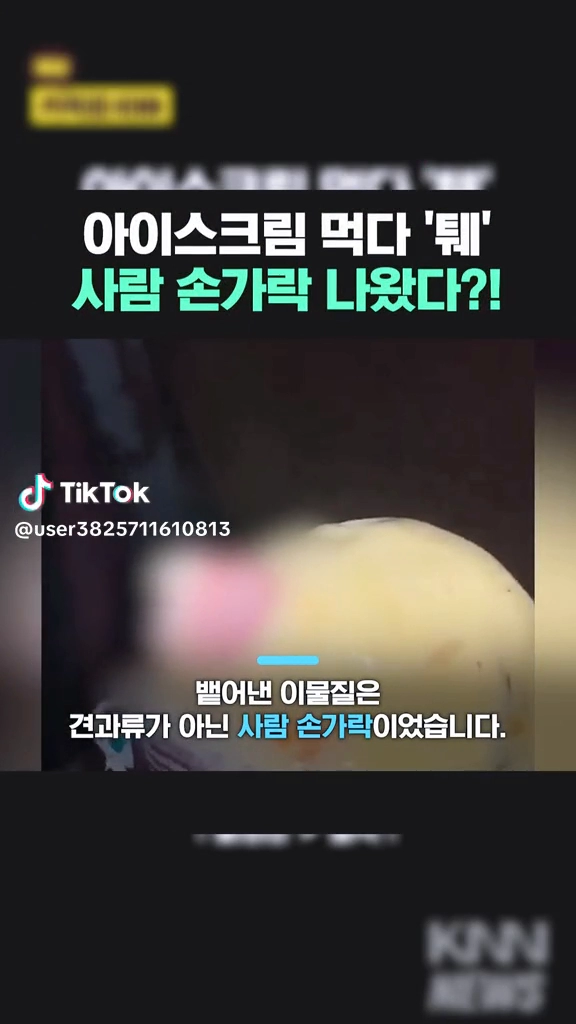 아이스크림 먹다 손가락 나왔다