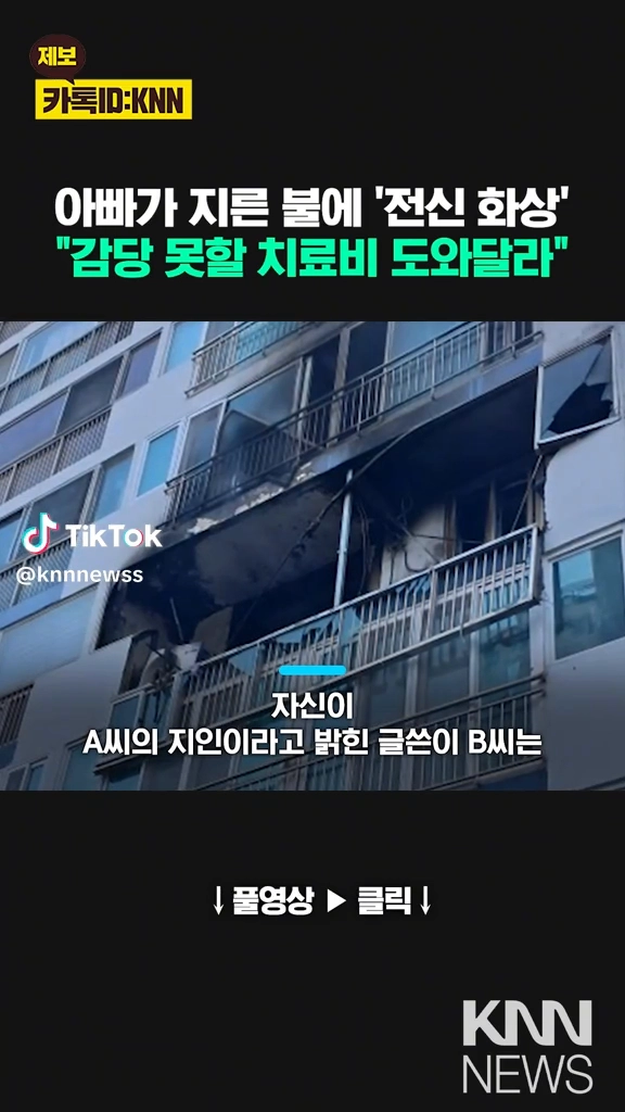 아빠가 지른 불에 전신화상